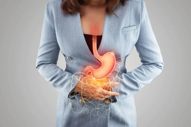 Intestinal inflammation (colitis)